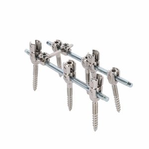 Posterior Spinal Fixation System
