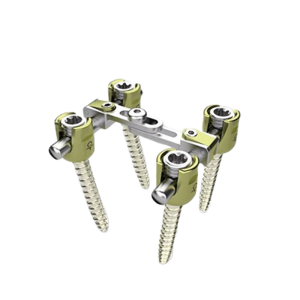 Orthopedic Posterior Spinal Fixation Segment